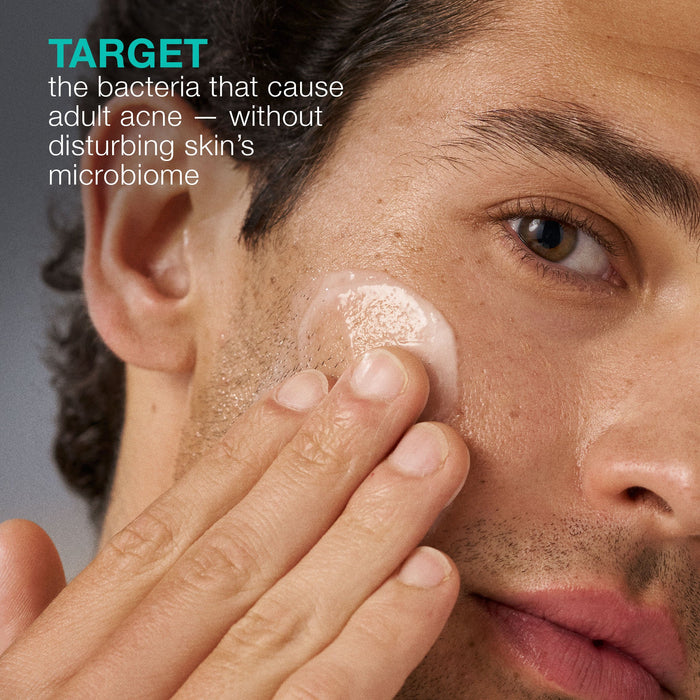 acne biotic moisturizer benefits