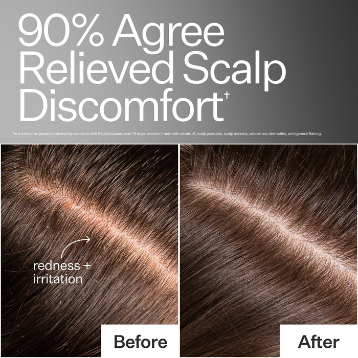 Act + Acre Microbiome Cooling Scalp Serum