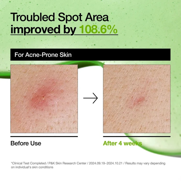 Anua - Azelaic Acid 10 Hyaluron Redness Soothing Serum