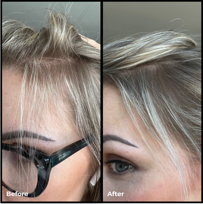 EVOLVh-Better Roots RootBoost Serum-