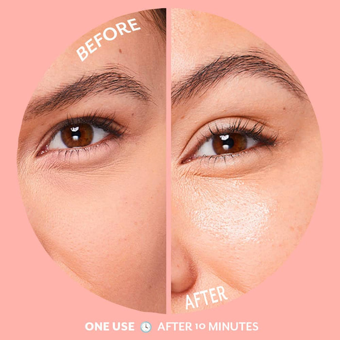 before and after woman using bubbly eye gels to brighten her under eyes with patches