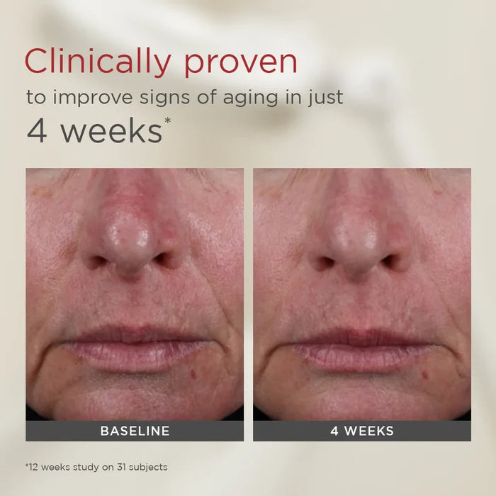 Clinical study comparison of facial skin before and after 4 weeks with EltaMD UV AOX Elements SPF 50