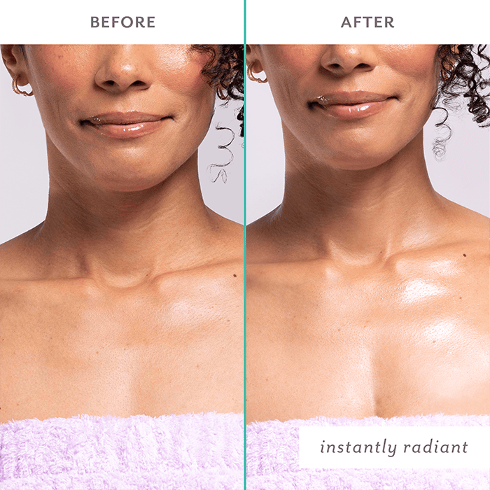 Before-and-after comparison showing improved skin radiance and glow on the neck and décolletage area after skincare use