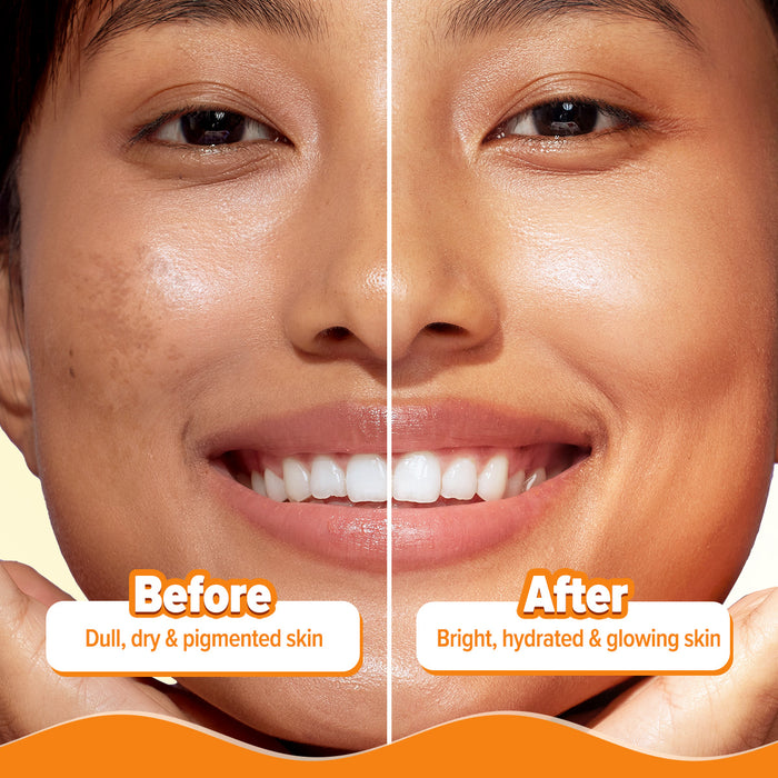 FREEBIE - Glow+ 30X* Vitamin C Hydrating Essence Serum- 50ml