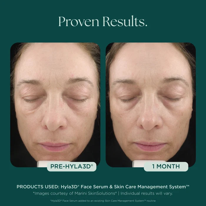 Hyla3D Face Serum Hyaluronic Acid Complex