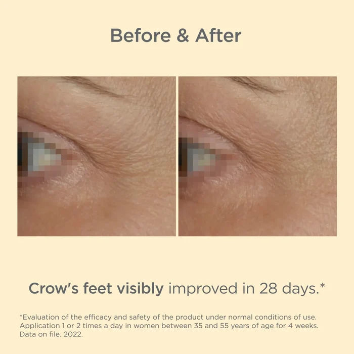 Before and after eye contour showing crow's feet visibly improved in 28 days